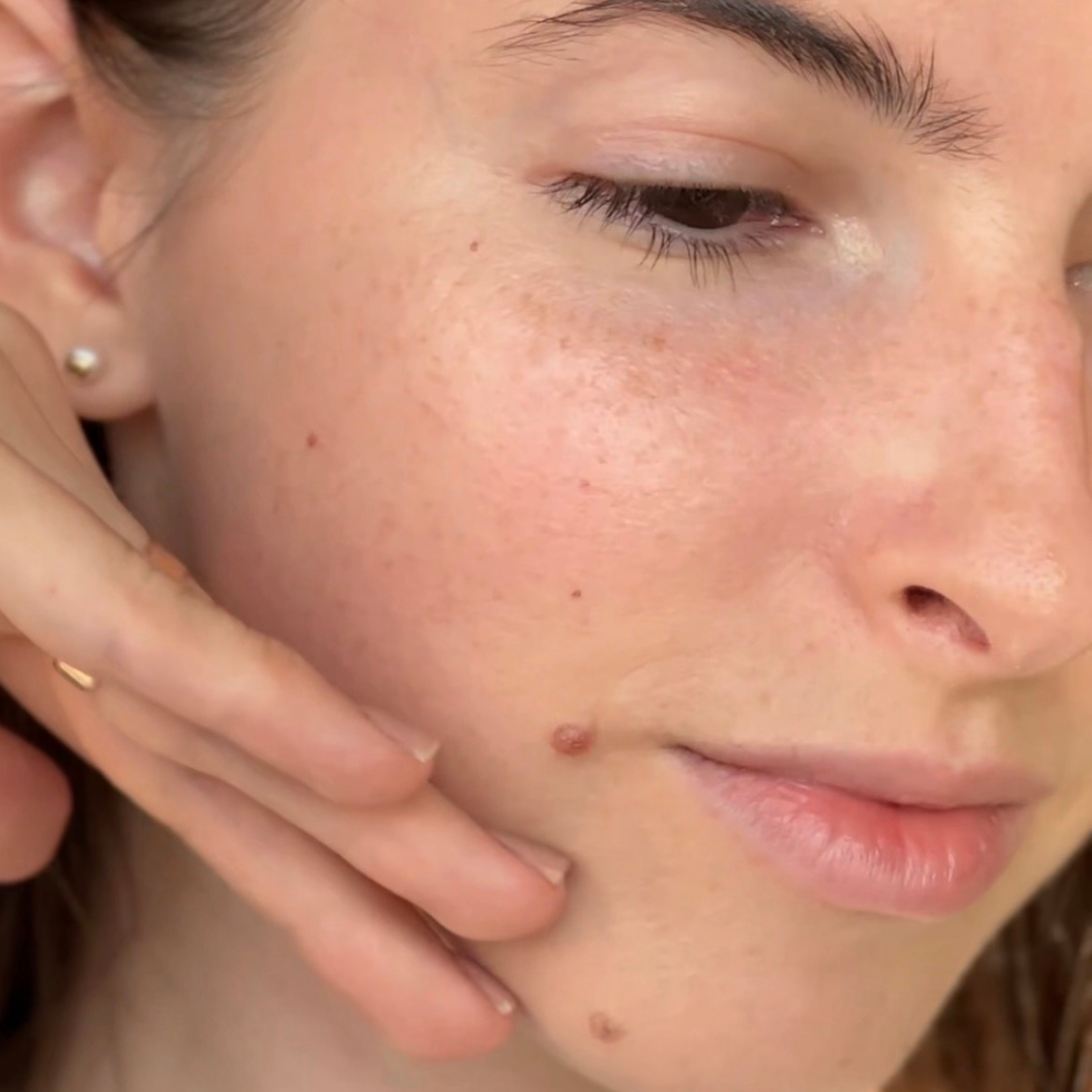 How to Choose Non Toxic Makeup for Acne Prone Skin